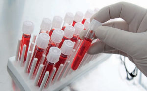 Laboratoire d'analyses médicales